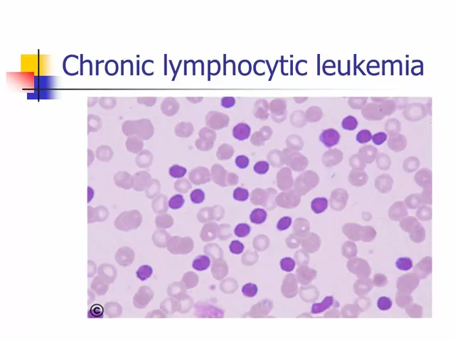 The Role of Ibrutinib in Treating Chronic Lymphocytic Leukemia